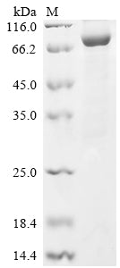 Greater than 85% as determined by SDS-PAGE.Recombinant Human Prolyl Endopeptidase Fap (FAP) Protein (His)