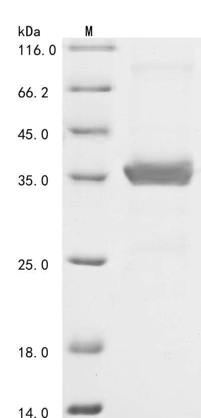 Greater than 85% as determined by SDS-PAGE.Recombinant Human Free Fatty Acid Receptor 3 (FFAR3) Protein (His-GST)