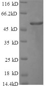 Greater than 90% as determined by SDS-PAGE.Recombinant Human Fibrinopeptide A (FGA) Protein (His)