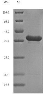 Greater than 90% as determined by SDS-PAGE.