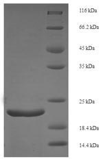 Greater than 90% as determined by SDS-PAGE.Recombinant Mouse Fibroblast Growth Factor 21 (FGF21) Protein (His)