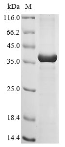 Greater than 85% as determined by SDS-PAGE.