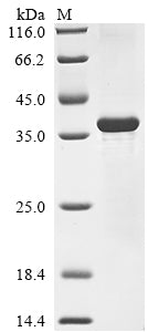 Greater than 85% as determined by SDS-PAGE.Recombinant Mouse Fibroblast Growth Factor 5 (FGF5) Protein (His)