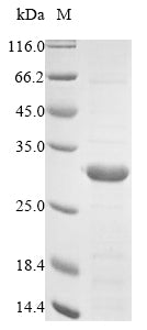 Greater than 85% as determined by SDS-PAGE.Recombinant Human Fibroblast Growth Factor Receptor 1 (FGFR1) Protein (His)