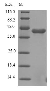 Greater than 85% as determined by SDS-PAGE.Recombinant Human Fibroblast Growth Factor Receptor 1 (FGFR1) Protein (His)