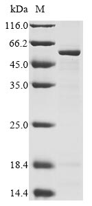 Greater than 85% as determined by SDS-PAGE.Recombinant Mouse Ribitol-5-Phosphate Transferase Fktn (FKTN) Protein (His&Myc)