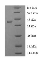 Greater than 90% as determined by SDS-PAGE.Recombinant Human Filaggrin (FLG) Protein (His-SUMO)