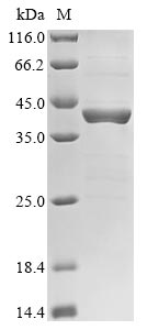 Greater than 85% as determined by SDS-PAGE.Recombinant Human Forkhead Box Protein M1 (FOXM1) Protein (GST)