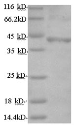 Greater than 90% as determined by SDS-PAGE.Recombinant Human Follicle-Stimulating Hormone Receptor (FSHR) Protein (His)