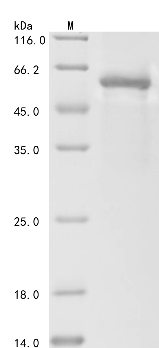 Greater than 85% as determined by SDS-PAGE.Recombinant Human Follicle-Stimulating Hormone Receptor (FSHR) Protein (His-Trx)