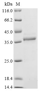 Greater than 85% as determined by SDS-PAGE.Recombinant Human Fragile X Mental Retardation Syndrome-Related Protein 1 (FXR1) Protein (His)