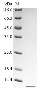 Greater than 90% as determined by SDS-PAGE.Recombinant Human Fragile X Mental Retardation Syndrome-Related Protein 1 (FXR1) Protein (His)