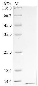 Greater than 90% as determined by SDS-PAGE.Recombinant Human Fragile X Mental Retardation Syndrome-Related Protein 1 (FXR1) Protein (His)