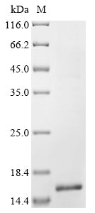 Greater than 90% as determined by SDS-PAGE.Recombinant Human Fragile X Mental Retardation Syndrome-Related Protein 1 (FXR1) Protein (His)