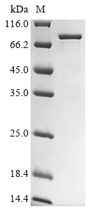 Greater than 85% as determined by SDS-PAGE.Recombinant Human Fragile X Mental Retardation Syndrome-Related Protein 1 (FXR1) Protein (His)