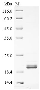 Greater than 85% as determined by SDS-PAGE.Recombinant Human Glucose-6-Phosphatase (G6PC1) Protein (His-SUMO)
