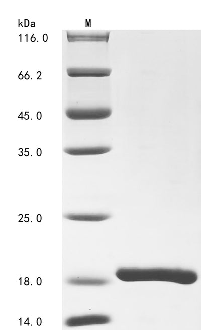 Greater than 90% as determined by SDS-PAGE.