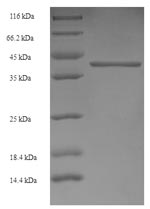 Greater than 90% as determined by SDS-PAGE.Recombinant Human Gamma-Aminobutyric Acid Receptor Subunit Alpha-4 (GABRA4) Protein (His-SUMO)