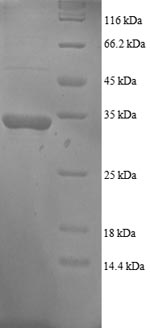 Greater than 90% as determined by SDS-PAGE.Recombinant Human Growth Arrest And Dna Damage-Inducible Protein Gadd45 Alpha (GADD45A) Protein (His-SUMO)