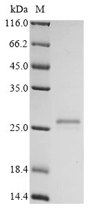Greater than 85% as determined by SDS-PAGE.Recombinant Human G Antigen 7 (GAGE7) Protein (His)