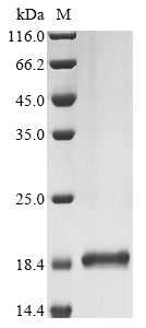 Greater than 90% as determined by SDS-PAGE.Recombinant Human Galanin Peptides (GAL) Protein (His&Myc)