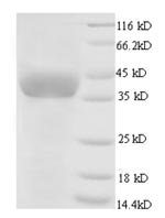 Greater than 90% as determined by SDS-PAGE.Recombinant Chicken Glyceraldehyde-3-Phosphate Dehydrogenase (GAPDH) Protein (His)