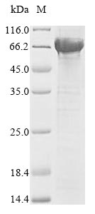 Greater than 85% as determined by SDS-PAGE.Recombinant Human Lysosomal Acid Glucosylceramidase (GBA1) Protein (His-SUMO&Myc)