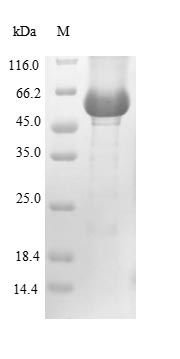 Greater than 85% as determined by SDS-PAGE.Recombinant Human Lysosomal Acid Glucosylceramidase (GBA1) Protein (His)