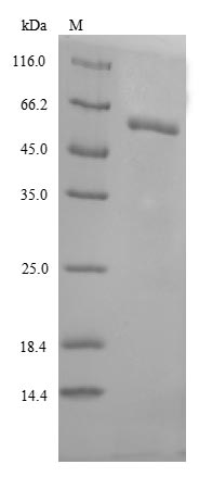 Greater than 85% as determined by SDS-PAGE.Recombinant Human Lysosomal Acid Glucosylceramidase (GBA1)