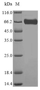 Greater than 85% as determined by SDS-PAGE.Recombinant Mouse Lysosomal Acid Glucosylceramidase (GBA) Protein (His-SUMO)