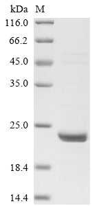 Greater than 85% as determined by SDS-PAGE.Recombinant Human Interferon-Induced Guanylate-Binding Protein 2 (GBP2) Protein (His)