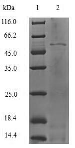 Greater than 90% as determined by SDS-PAGE.Recombinant Human Vitamin D-Binding Protein (GC) Protein (His)