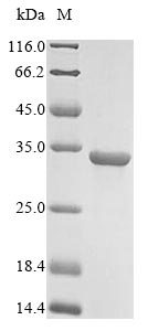Greater than 85% as determined by SDS-PAGE.Recombinant Human Pro-Glucagon (GCG) Protein (His-GST)