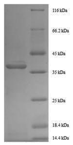 Greater than 90% as determined by SDS-PAGE.Recombinant Human Growth/Differentiation Factor 11 (GDF11) Protein (His-SUMO)