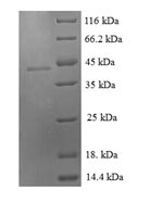 Greater than 90% as determined by SDS-PAGE.Recombinant Human Growth/Differentiation Factor 9 (GDF9) Protein (GST)