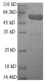 Greater than 90% as determined by SDS-PAGE.Recombinant Mouse Glial Fibrillary Acidic Protein (GFAP) Protein (His-SUMO)