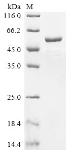 Greater than 85% as determined by SDS-PAGE.