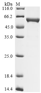 Greater than 85% as determined by SDS-PAGE.Recombinant Rat Glial Fibrillary Acidic Protein (GFAP) Protein (His)