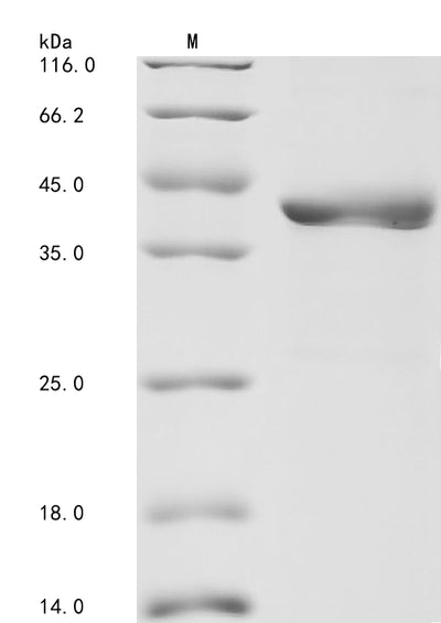 Greater than 85% as determined by SDS-PAGE.Recombinant Human Gamma-Glutamyl Hydrolase (GGH) Protein (His-GST&Myc)