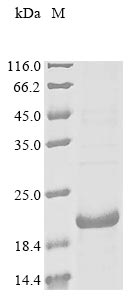 Greater than 85% as determined by SDS-PAGE.Recombinant Mouse Gastric Inhibitory Polypeptide Receptor (GIPR) Protein (His&Myc)