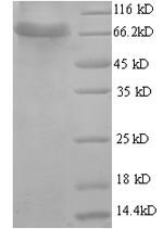 Greater than 90% as determined by SDS-PAGE.Recombinant Human D-Glucuronyl C5-Epimerase (GLCE) Protein (His)