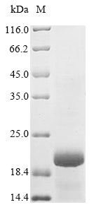 Greater than 90% as determined by SDS-PAGE.Recombinant Human Glucagon-Like Peptide 1 Receptor (GLP1R) Protein (His)