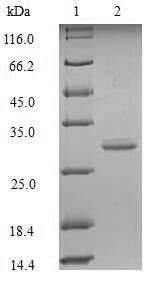 Greater than 90% as determined by SDS-PAGE.Recombinant Mouse Glucagon-Like Peptide 1 Receptor (GLP1R) Protein (His-SUMO)