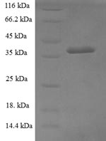 Greater than 90% as determined by SDS-PAGE.