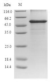 Greater than 90% as determined by SDS-PAGE.Recombinant Human Alanine Aminotransferase 1 (GPT) Protein (His)