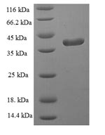 Greater than 90% as determined by SDS-PAGE.Recombinant Human Glutathione Peroxidase 1 (GPX1) Protein (His-SUMO)