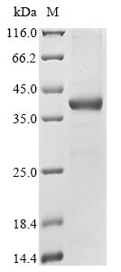 Greater than 85% as determined by SDS-PAGE.