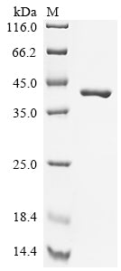 Greater than 90% as determined by SDS-PAGE.Recombinant Mouse Glutathione S-Transferase Mu 1 (GSTM1) Protein (His-SUMO)