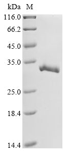 Greater than 90% as determined by SDS-PAGE.Recombinant Mouse Glutathione S-Transferase Mu 3 (GSTM3) Protein (His&Myc)