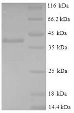 Greater than 90% as determined by SDS-PAGE.Recombinant Mouse Glutathione S-Transferase P 1 (GSTP1) Protein (His-SUMO)